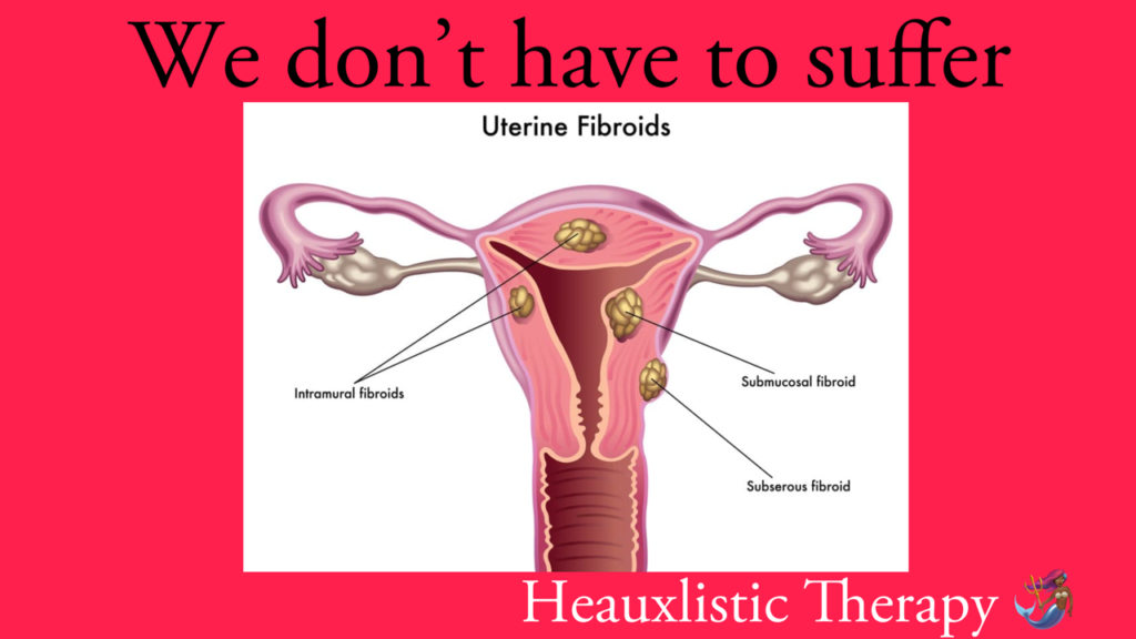 SUFFERING WITH FIBROIDS?CHECK MY NOV 20TH AMAZON SHOPPING LIST.